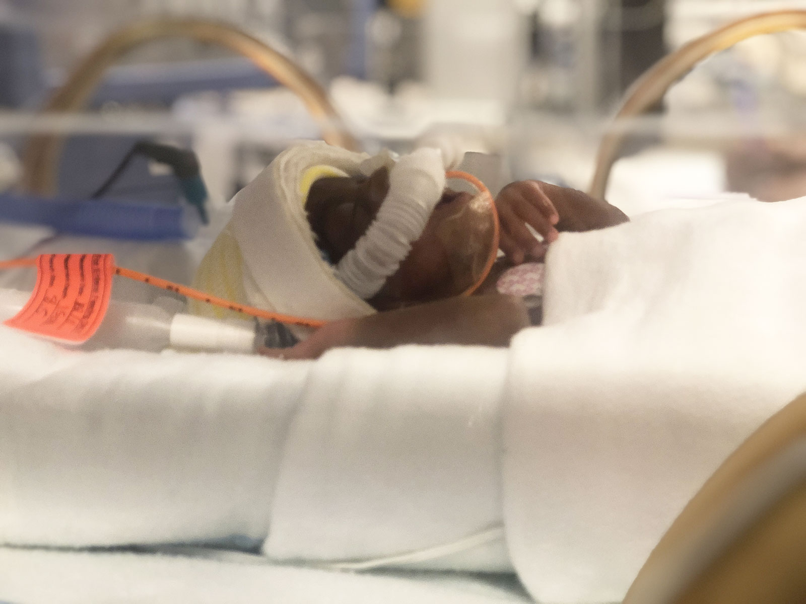 Baby in the NICU
