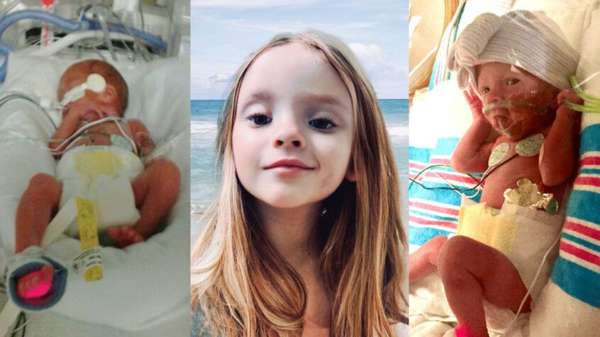 Alvarez babies | ICU baby